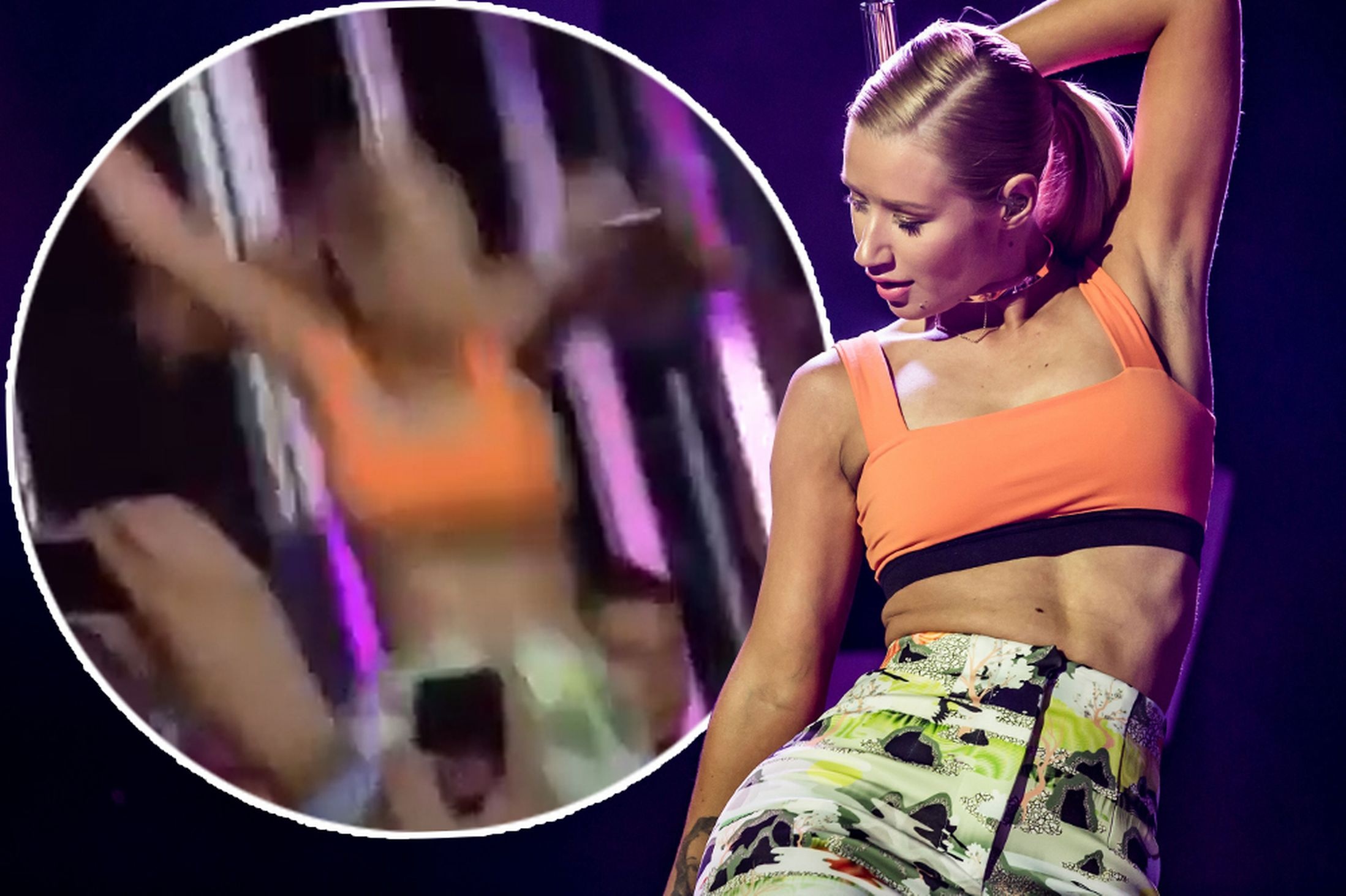 Trước Nicki Minaj, nữ ca sĩ trẻ Iggy Azalea cũng là nạn nhân của tai nạn nghề nghiệp. Trong sự kiện tiền MTV VMAs, khi đang biểu diễn hit Fancy, Iggy đi lùi và không may ngã xuống sân khấu, cô phải nhờ cậy một vài người nâng dậy biểu diễn tiếp. Nữ ca sĩ được một phen hú vía và cảm thấy may mắn vì đã không bị gãy chân.  