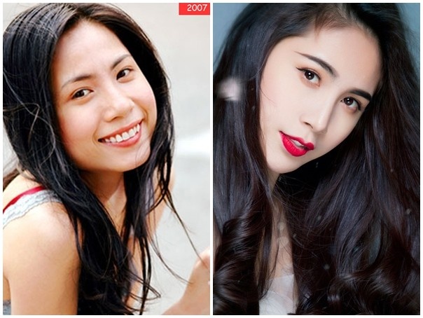 4 bo phan co the duoc my nhan Viet cham chi 'trung tu' hinh anh