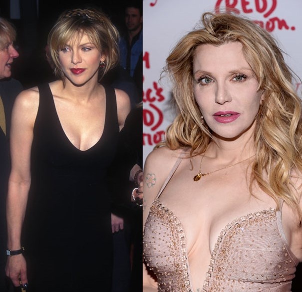 Danh ca đồng quê Courtney Love từng chia sẻ cô cảm thấy hối tiếc vì đã đụng đến dao kéo: bơm môi quá đà và sửa mũi khiến dung nhan không còn sức sống như ngày trước.
