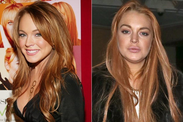 Lindsay Lohan cũng là ngôi sao nghiện dao kéo từ việc sửa ngực cho đến căng da mặt, bơm môi. Theo thời gian, dù chưa đến 30 tuổi nhưng gương mặt của ngôi sao The Parent Trap đã xuống cấp trầm trọng.