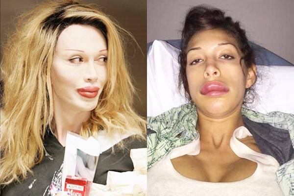 Nhung doi moi dao keo hong cua sao Hollywood hinh anh