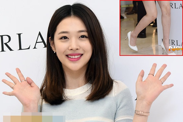 Sulli f(x) bi nghi tiem chat giam beo chan hinh anh