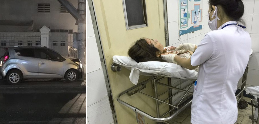 Bà xã Huỳnh Đông gặp tai nạn xe hơi: Tối 13/2, trong lúc đang cầm láy, diễn viên - người đẹp Ái Châu đã gặp tai nạn vì chiếc xe ô tô bỗng dưng nổ lốp rồi lao vào cột điện gần đó. Cú tông khiến phần đầu của á hậu Phụ nữ Việt Nam 2005 va đập mạnh vào vô lăng.