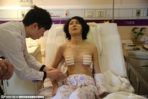 Sau đó, Lưu Đình tiến hành các ca phẫu thuật nâng ngực, chỉnh sửa bộ phận sinh sản. 