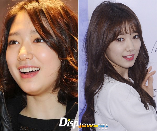 Kiều nữ Park Shin Hye sở hữu vẻ đẹp bụ bẫm, dễ thương, điều này trái ngược với xu hướng làm đẹp chung của showbiz Hàn. Thời mới vào nghề, Park Shin Hye có vóc dáng khá tròn trịa. Qua thời gian, nữ diễn viên The Heirs tích cực giảm cân. Hiệu quả đến rõ rệt nhất là gương mặt không còn ngấn mỡ mà thay vào đó là chiếc cằm V-line. 