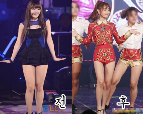 Thời điểm Song Ji Eun của Secret xuống cân, chỉ còn 45kg, cô thay đổi khá nhiều từ gương mặt cho đến vóc dáng. Nữ ca sĩ từng giảm 10kg chỉ trong 2 tuần lễ sau khi đọc những lời bình luận ác ý của cư dân mạng về thân hình cô. 