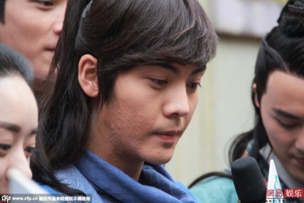 Ở nhiều góc ảnh, vùng mẩn của sao nam trong Cổ kiếm kỳ đàm lộ rõ khiến vẻ mỹ nam hoàn hảo của anh suy giảm không ít.