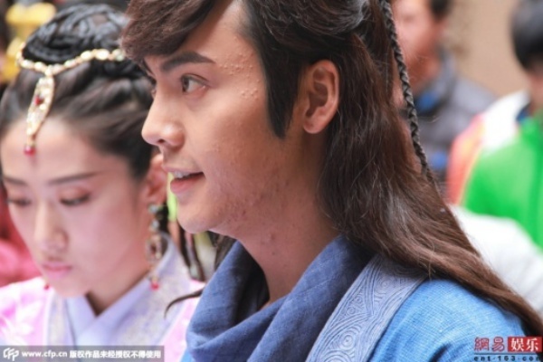 Trần Vỹ Đình ngượng ngùng khi phóng viên chụp cận mặt. Anh cho biết đang bị rối loạn nội tiết dẫn đến việc mặt xuất hiện các nốt: “Mặt tôi giờ giống mặt đậu quá”.