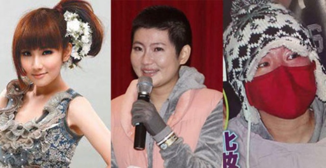 Ngày 22/10/2010, Selina cùng bạn diễn Du Hạo Minh gặp tai nạn bất ngờ trên trường quay Tôi có hẹn với mùa xuân tại Thượng Hải. Thời điểm đó, tính mạng cô như “ngàn cân treo sợi tóc”. Selina trải qua nhiều ca phẫu thuật cấy ghép da,từng có hiện tượng nhiễm trùng nặng. Sau tai nạn, từ cô gái xinh đẹp nhất nhóm nhạc, cô trở nên phù tướng, đầy sẹo, đi lại khó khăn. Giữ được tính mạng, nhưng ngay cả những người lạc quan nhất cũng không dám mơ về cuộc sống của cô sau đó. Vì thế, đến giờ, hình ảnh của Selina được ca ngợi là “biểu tượng của vẻ đẹp tái sinh” khi cô ngày ngày chuyên tâm với công việc.