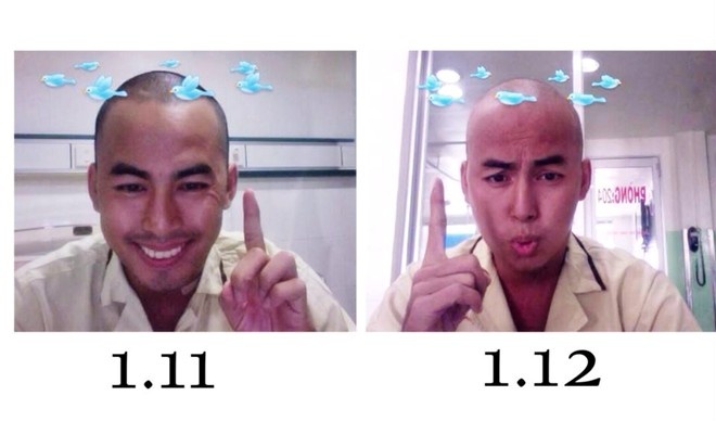 Đầu tháng 12, sau 1 tháng điều trị hóa chất, Duy Nhân có thể ăn được cơm, nói chuyện, cổ họng cũng đỡ đau, tóc và râu rụng hết. Chị gái Duy Nhân cho biết, anh được truyền hóa chất 2 ngày một lần nếu sức khỏe bình thường. Người mẫu sinh năm 1986 phải trải qua 3 đợt truyền tiêu tốn khoảng gần <abbr class=