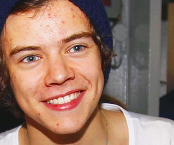 Sao Hollywood bi am anh vi mun hinh anh