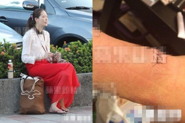 Nhưng vài năm trước, Diêu Thái Dĩnh đã gặp chấn động tâm lý sau vụ cưỡng hiếp. Thêm vào đó, khi vụ việc thiếu gia Lý Tông Hựu cưỡng hiếp nhiều người rầm rộ trên các báo, Diêu Thái Dĩnh cũng bị nhắc đến như một nạn nhân, điều này khiến tâm lý của cô càng mất kiểm soát. Cô từng có ý định tự tử. Quản lý của Diêu Thái Dĩnh trao đổi với phóng viên thừa nhận, nữ diễn viên này đang phải điều trị bệnh trầm cảm và bệnh hở van tim.  Giờ đây, cô sống cảnh không nghề nghiệp ổn định, các bầu show thiếu mặn mà với một người mẫu có vóc dáng xuống dốc.