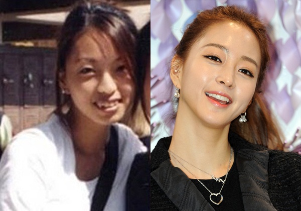 Bức ảnh cũ cho thấy người đẹp Han Ye Seul phải chỉnh sửa rất nhiều chi tiết trên gương mặt từ đôi mắt đến hàm răng.