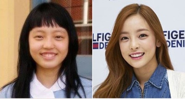 Hàm răng ngô nhỏ xíu khiến Goo Hara hở lợi khi cười. Nữ ca sĩ đã khắc phục nhược điểm bằng hàm răng mới, hạn chế phần hở lợi.