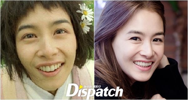 Hàm răng tự nhiên của Kang Hye Jung khá thô. Răng cửa to hơn hẳn so với răng còn lại. Hiện tại, nữ diễn viên có thể thoải mái khoe răng đều tăm tắp.