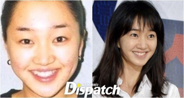 Hàm răng đều giúp người đẹp khóc Soo Ae cười rạng rỡ hơn.