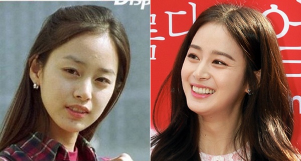 Hàm răng đều tăm tắp của mỹ nhân Kim Tae Hee cũng là thành quả của nha khoa.