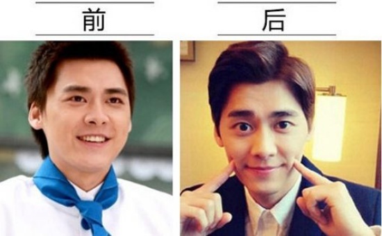 Lý Dịch Phong từng tròn trịa và chỉ là diễn viên hạng B. Sau vài năm khởi nghiệp, hiện, anh là nam thần trong lòng khán giả.