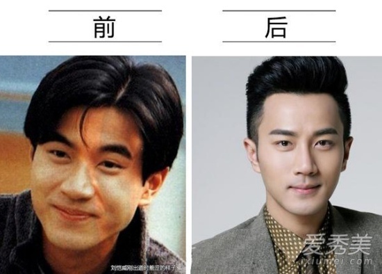 Lưu Khải Uy là tiểu sinh đáng chú ý khi còn dưới trướng TVB. Nhưng anh lại không được o bế. Có tin đồn, Khải Uy phẫu thuật thẩm mỹ 