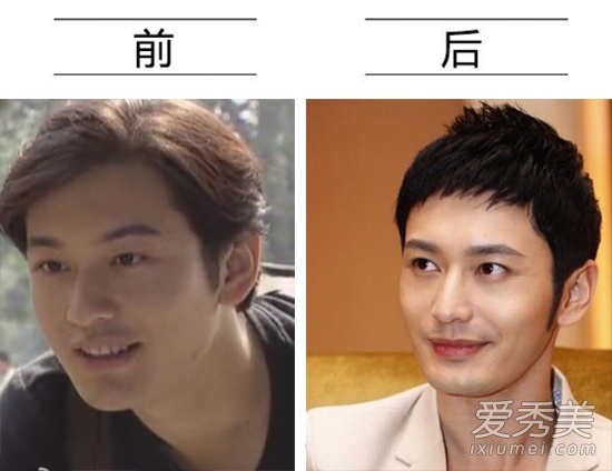 Thời mới gia nhập làng giải trí, gương mặt góc cạnh của Huỳnh Hiểu Minh khá nổi bật. Những năm gần đây, anh liên tục vướng nghi án đã thẩm mỹ vì thay đổi quá lớn. Mũi cao hơn, vùng cằm thon gọn đáng kể, Huỳnh Hiểu Minh bị cho phẫu thuật thẩm mỹ cách đây vài năm. Mặc cho thị phi về dao kéo, sự nghiệp tài tử ngày càng phát triển. Anh hiện là sao hạng A của showbiz Hoa ngữ. Điều mà 15 năm trước, anh không dám nghĩ tới.