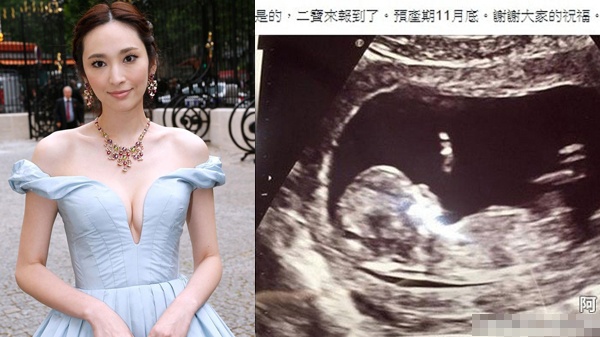 Ngô Bội Từ khoe ảnh siêu âm thai nhi.