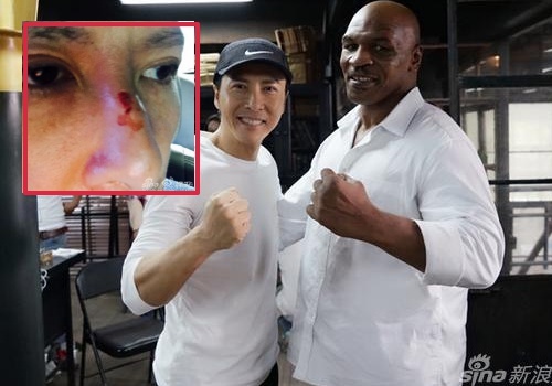 Chan Tu Dan vo mui, phu nhan do Mike Tyson can hinh anh