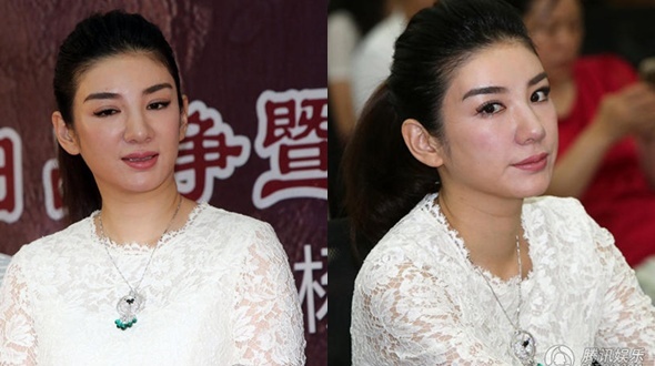 Gương mặt sưng phù của Huỳnh Dịch khiến nhiều người đánh giá cô đang chịu hậu quả của quá trình thẩm mỹ.