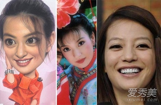 Triệu Vy khi còn trẻ sở hữu đôi mắt to tròn ngây thơ. Nhưng ở tuổi U40, gương mặt với nếp nhăn đã khiến đôi mắt của trở nên thiếu sự trẻ trung. Người đàn ông khởi kiện cô cho biết mỗi khi cô trừng mắt, ông này đều sợ hãi nên quyết định kiện. Đơn kiện sau đó bị tòa án Phố Đông, Thượng Hải bác đơn.