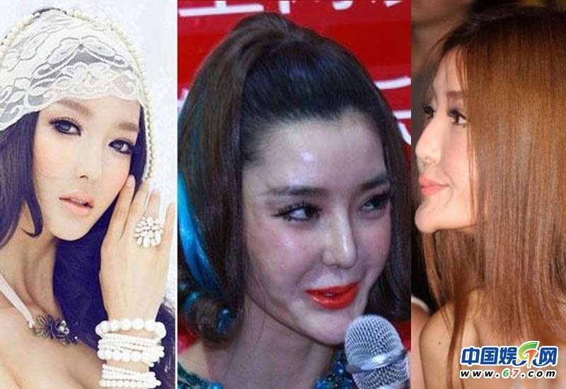 Lý Dĩnh Chi những năm gần đây đau đầu vì nghi vấn thẩm mỹ. Đặc biệt chiếc cằm nhọn tới 45 độ của cô bị đánh giá “thẩm mỹ hỏng”. Trang Sina từng ví von cô giống hệt phù thủy trong phim.