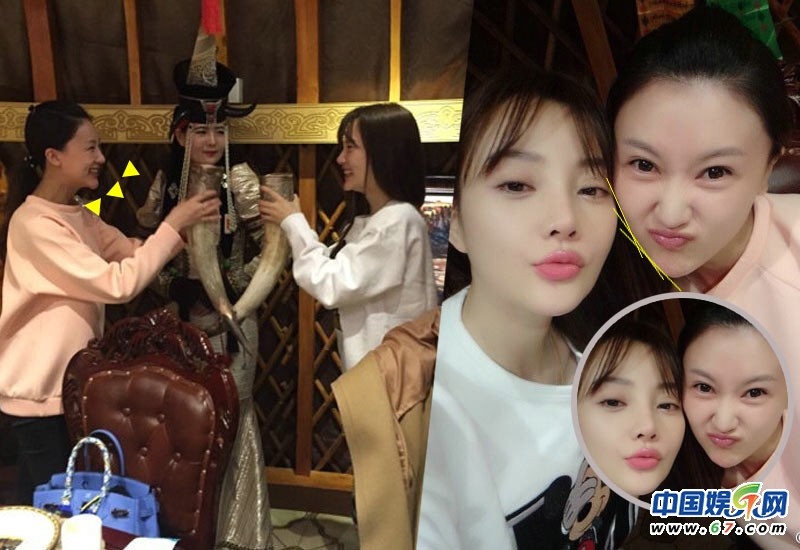 Cam Vi (trái) cũng bị cho thẩm mỹ gọt mặt, độn cằm khi nhìn nghiêng vùng cằm của cô lộ dấu hiệu khác thường.