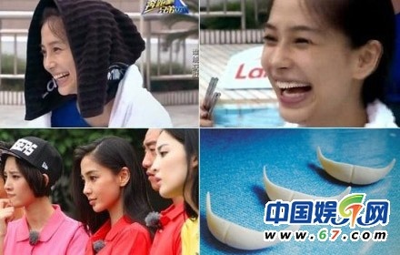 Angela Baby với vùng cằm bị cho là thảm họa, tựa như lót cả miếng độn ở dưới.