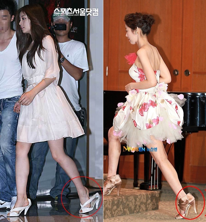 Đây là lỗi khá phổ biến với các sao nữ. JI Yeon của nhóm T-ara, diễn viên Yoo Pil Ran từng rơi vào tình huống này. 