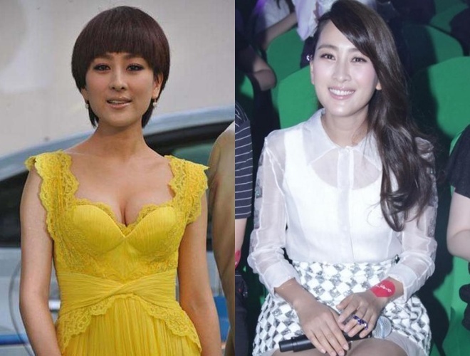 Cô phủ nhận việc gọt mặt sau khi ảnh quá khứ (trái) bị phát tán.