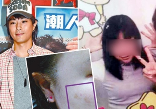 Tai tu TVB bi tung chung cu hanh hung 'ban gai nha ngheo' hinh anh