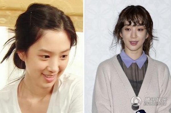 Jung Ryeo Won - mỹ nhân phim Tên tôi là Kim Sam Soon bị nghi vấn gọt mặt. Hiện, gương mặt của cô có nét xô xệch.