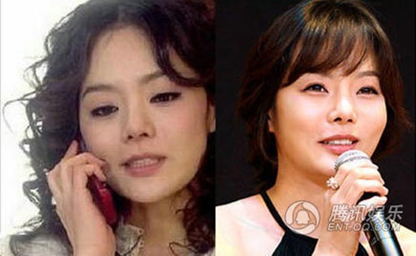 Chae Rim vốn được coi là mỹ nhân tự nhiên những năm qua. Nhưng gần đây, khi xuất hiện trong nhiều sự kiện, cô gây ngạc nhiên vì vùng mặt cứng đờ như sáp. Lập tức, Chae Rim bị nghi vấn dao kéo quá đà.