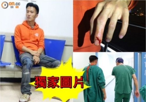 Ta Dinh Phong voi nhap vien do chay mau tay hinh anh