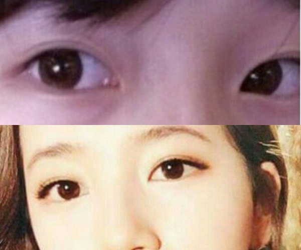 Sự khác biệt ở đôi mắt của Suzy trước đây (ảnh trên) và hiện giờ.