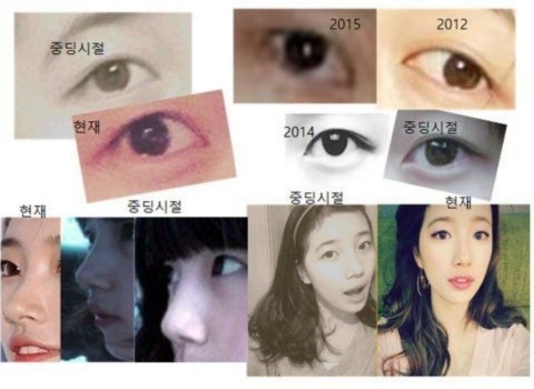 Cư dân mạng bênh vực Suzy bằng cách tung bằng chứng cho rằng cô không thẩm mỹ.