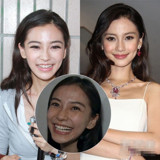 Angela Baby vướng nhiều tin đồn thẩm mỹ. Nhưng Huỳnh Hiểu Minh khẳng định đây chỉ là tin tức sai sự thật, và bạn gái anh đẹp nhờ công nghệ trang điểm. Anh từng tâm sự khi để mặt mộc, Angela Baby không đẹp. Quả thật, với tấm ảnh đời thường, khó ai có thể nhận ra đây là nàng Vân Trung Ca khuynh thành.