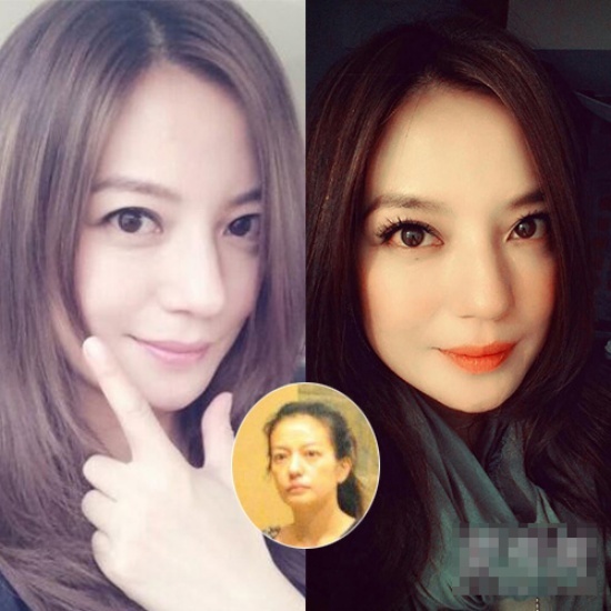 Triệu Vy lộ tuổi tác trên gương mặt hốc hác khi để tự nhiên.