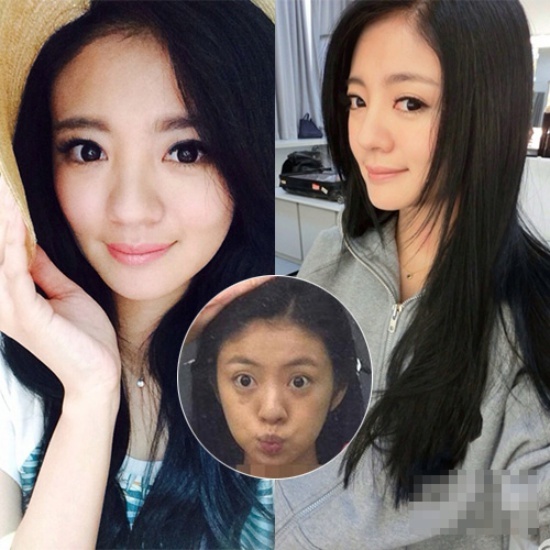 An Dĩ Hiên khác xa hình ảnh trang điểm đến 90%. Làn da có mụn, vùng quầng thâm và nếp nhăn xuất hiện nên trông cô già hơn cả chục tuổi.