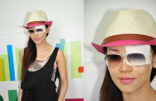 Dương Tư Kỳ bị tổn thương vùng mắt.