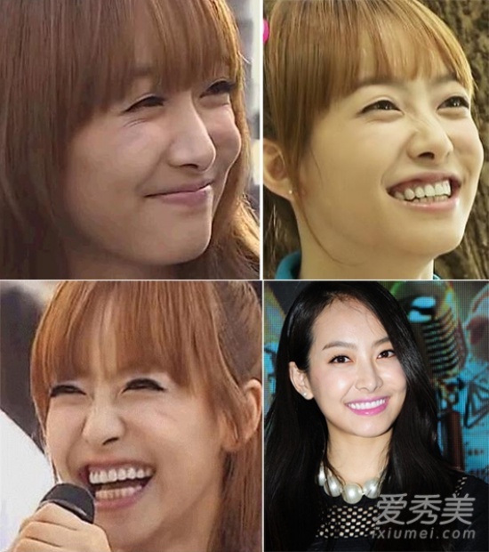 Nụ cười rộng hở lợi kém duyên của Victoria (Fx).