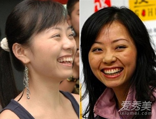 Trương Lương Dĩnh với gương mặt mộc, nụ cười không sáng sủa.