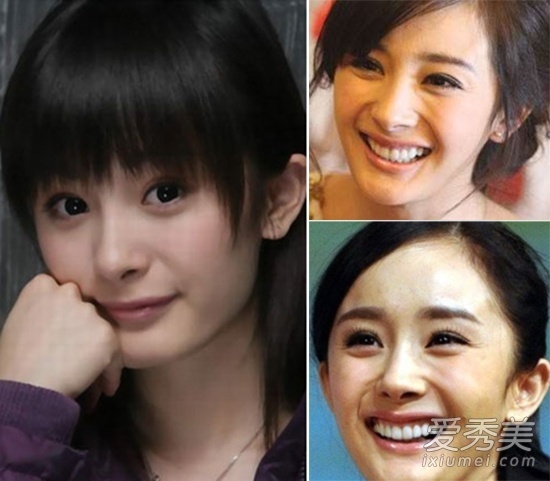 Dương Mịch cũng không được khen có nụ cười quyến rũ vì hở lợi.