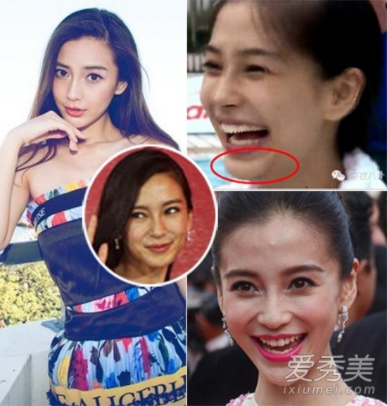 Angela Baby sở hữu vẻ đẹp lai Đức rất quyến rũ. Nhưng khi cô cười, nghi vấn thẩm mỹ lại nổ ra. Nhiều người cho rằng, nụ cười của Angela Baby giả tạo, không đẹp.