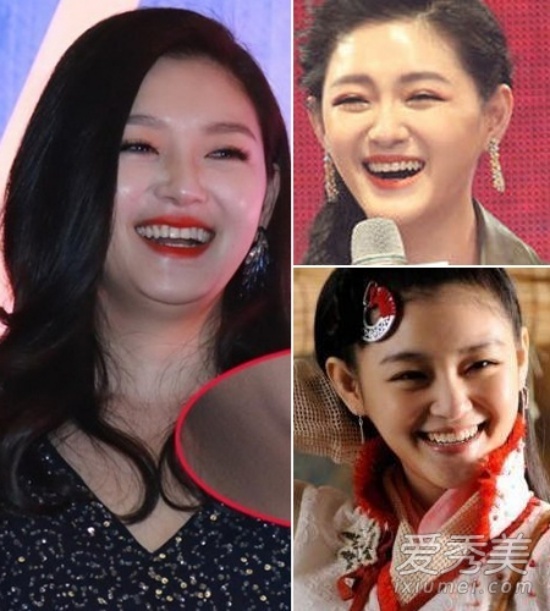 Khi cười, Đại S dễ dàng lộ gương mặt béo và vùng cằm ngấn mỡ.