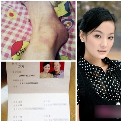 Phương Bá Nghê tung bằng chứng bị chồng bạo hành.