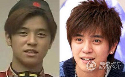 “Lương Sơn Bá” La Chí Tường đối diện nghi án đã sửa mắt từ nhiều năm trước.